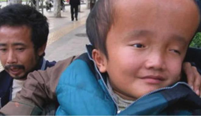 10多年过去曾经因三鹿奶粉的“大头娃”如今现状怎么样？(图2)