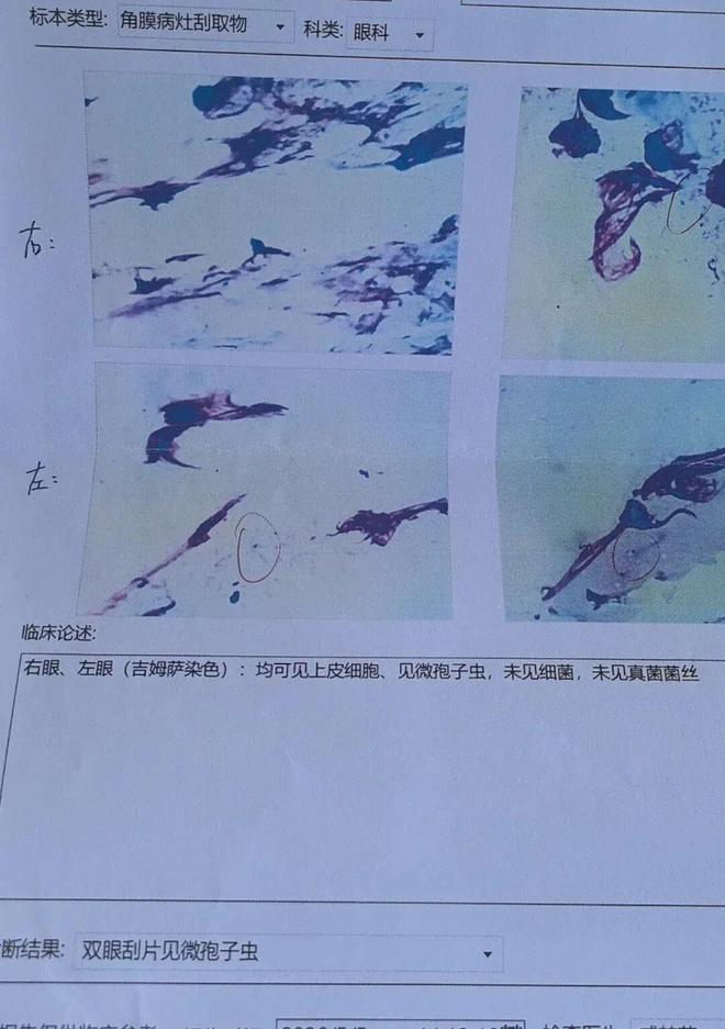 九游体育：女子养鹦鹉20天感染寄生虫辗转3家医院才确诊！专家：定期驱虫避免过度亲密接触(图2)